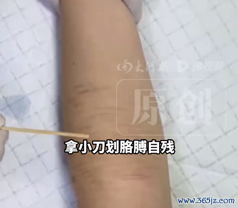 高三女生高考前表白被拒自残住院 大夫判断：是失恋导致的心扉波动和自我怀疑